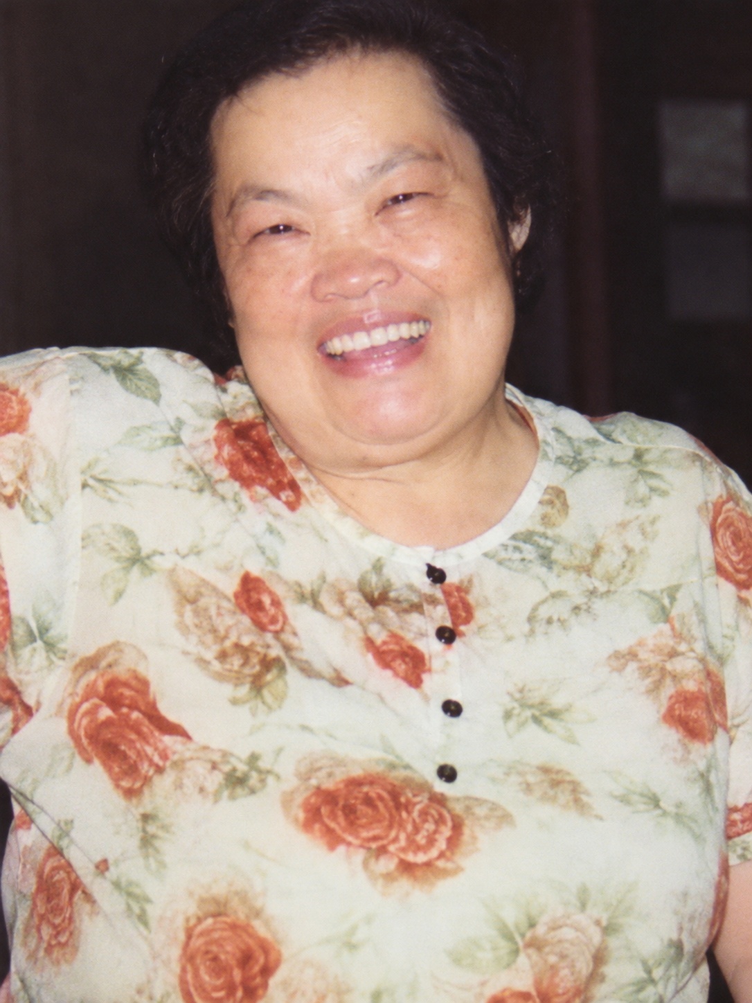 Chen Chunmei before taking enzyme.